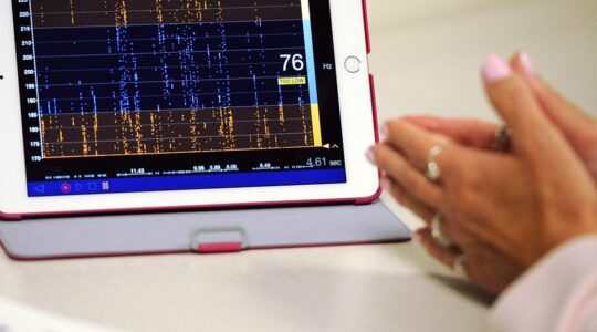 A voice therapy app runs on an iPad