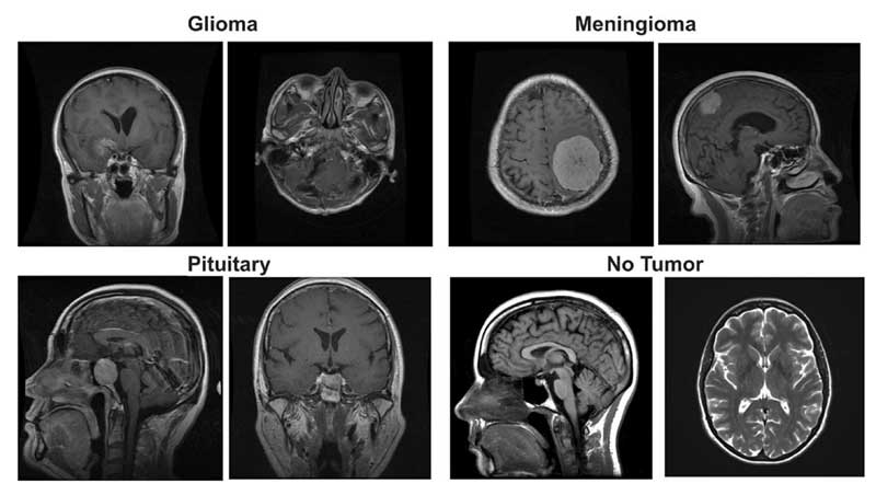 An image showing eight brain scans in black and white